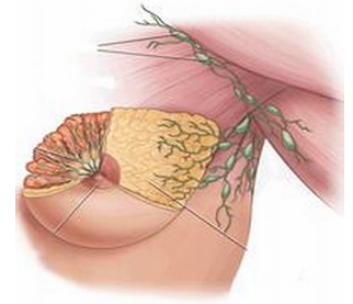乳腺纤维瘤的症状有哪些