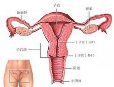 子宫肌瘤的症状有哪些
